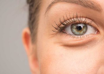 علت پف زیر چشم و ورم دور چشم چیست؟