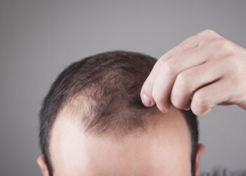 موثرترین روش های تقویت موهای نازک