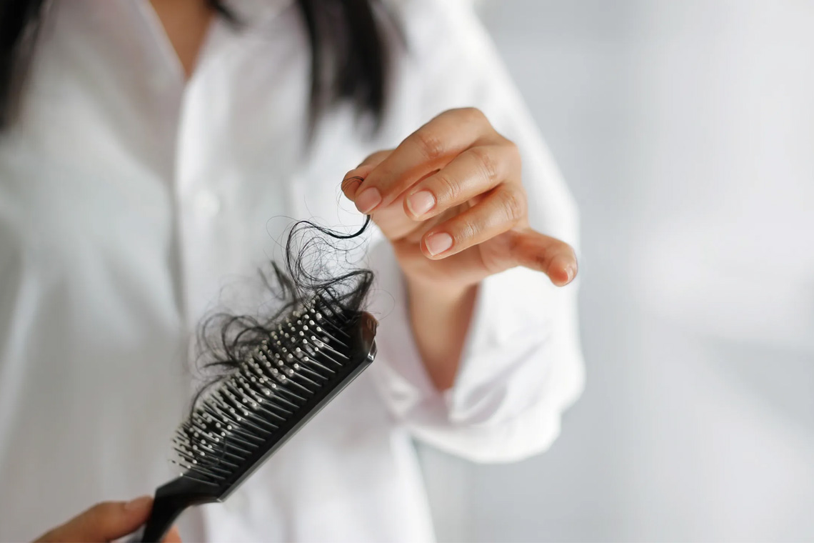 روش‌ های جلوگیری از ریزش مو
