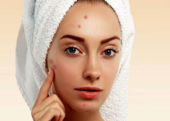 چند روش‌ خانگی و آسان درمان جای جوش