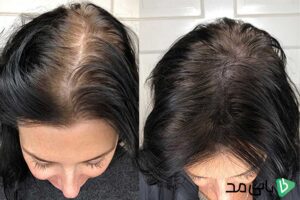 روش‌هایی که موهای شما را پرتر نشان می‌دهد