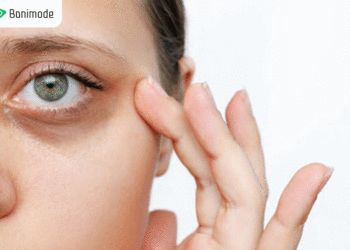 معرفی بهترین روش‌ها برای از بین بردن تیرگی زیر چشم