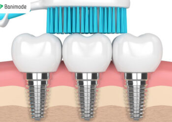 بهترین مسواک برای ایمپلنت | معرفی 5 مدل مسواک مناسب ایمپلنت